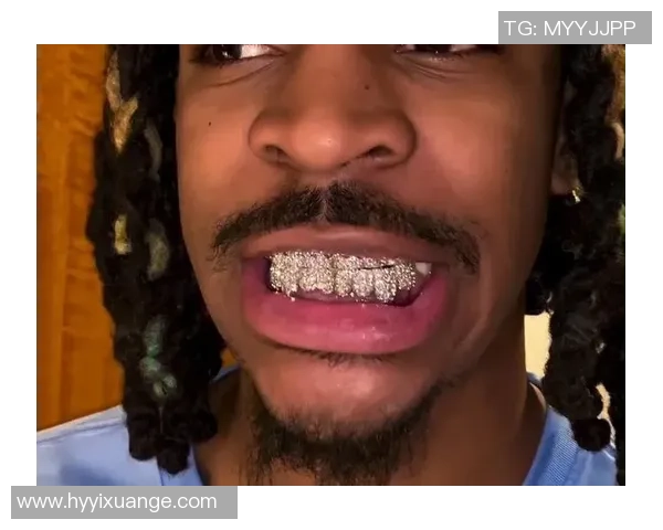 戴牙套踢球?世界级球星都不例外 戴牙套踢球?世界级球星都不例外